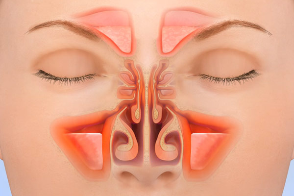 nasal congestion rhinoplasty nasal surgery los angeles ca rhinoplasty nose surgery nasal congestion rhinoplasty nasal surgery los angeles ca rhinoplasty nose surgery